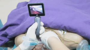 Tomahawk Intubatio Understanding Intubation Blades Types: A Comprehensive Guide